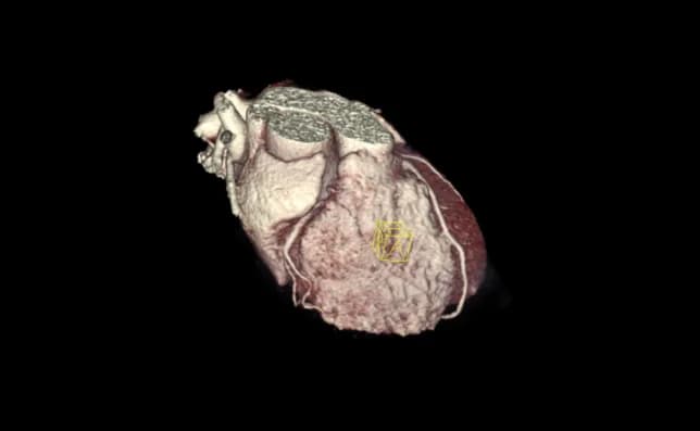 Kardio-CT