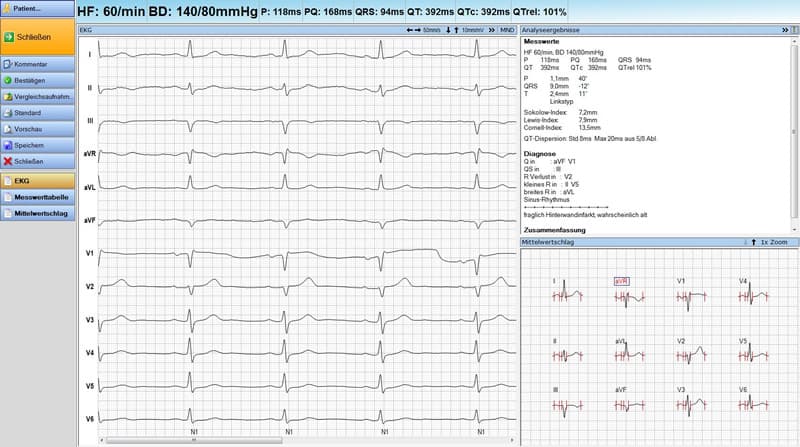 Ruhe-EKG